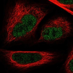 GAPDH-2 Antibody, Novus Biologicals 25 &mu;L, Unlabeled:Antibodies, Polyclonal